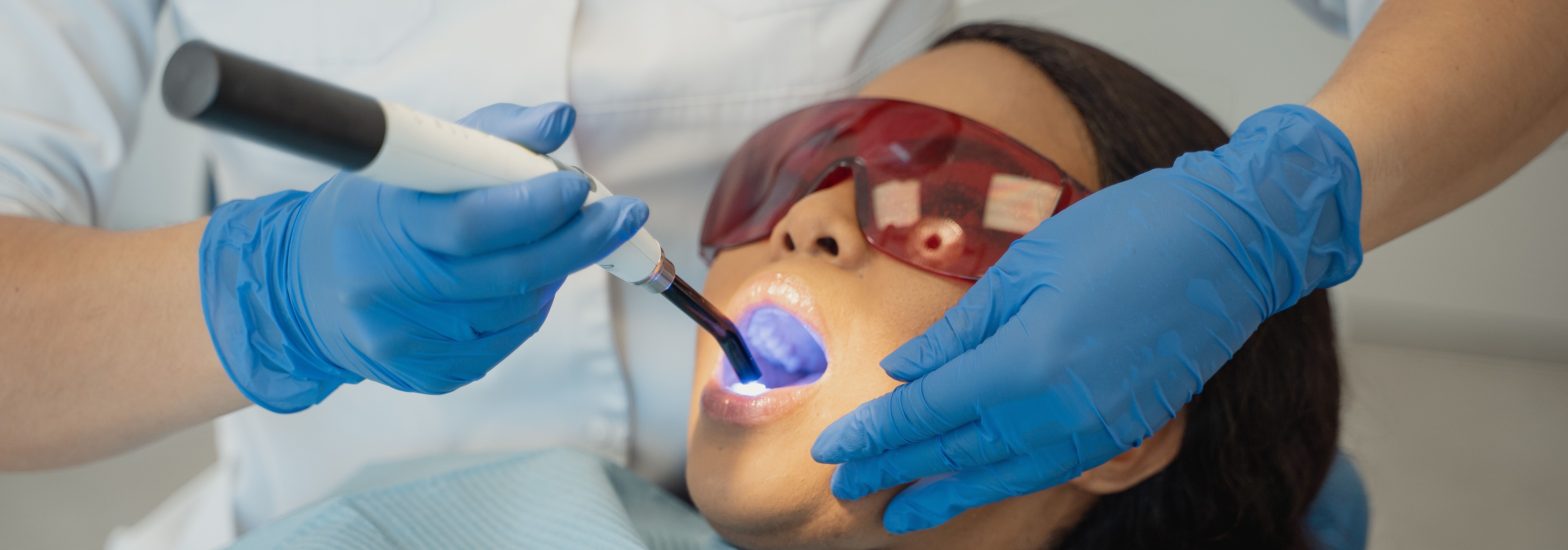 The Best Dental Curing Lights for Professional Use: A Buyer's Guide