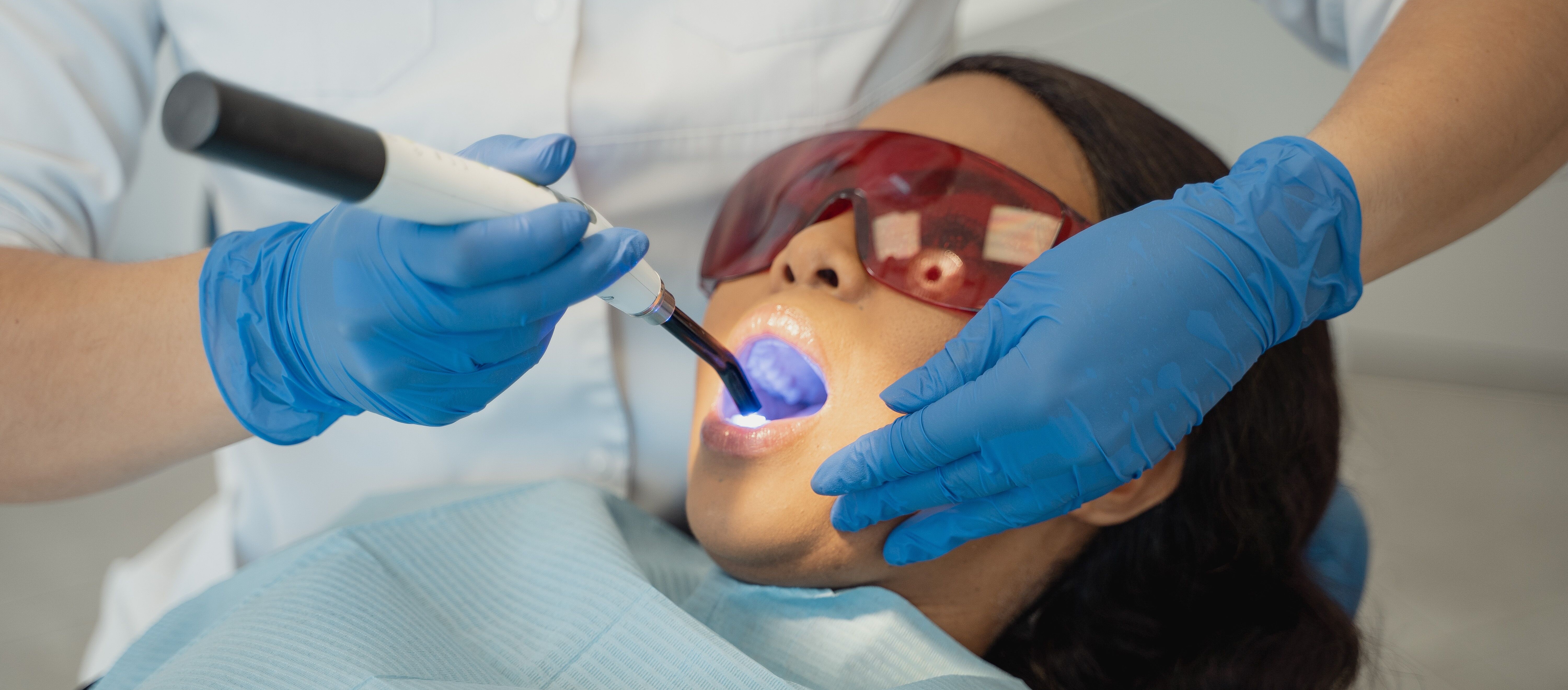 The Best Dental Curing Lights for Professional Use: A Buyer's Guide 